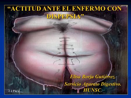 Elisa Borja Gutiérrez. Servicio Aparato Digestivo. HUNSC.