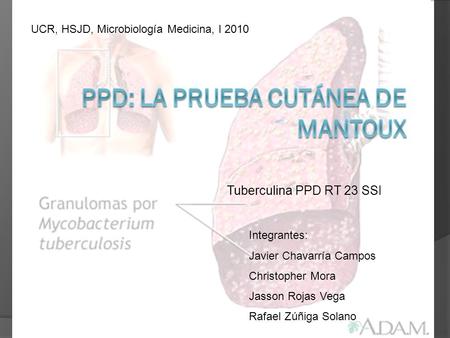 PPD: la prueba cutánea de Mantoux