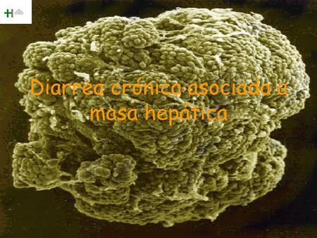 Diarrea crónica asociada a masa hepática