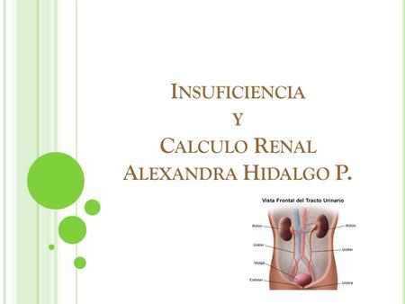 Insuficiencia y Calculo Renal Alexandra Hidalgo P.