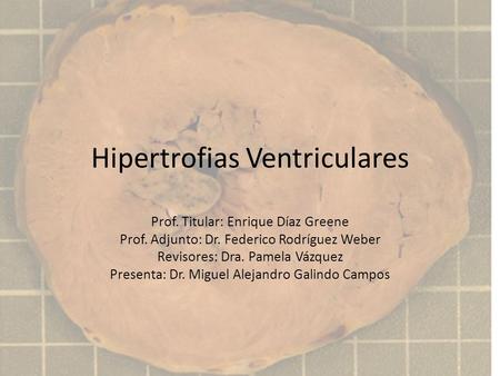 Hipertrofias Ventriculares