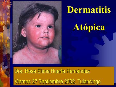 Dermatitis Atópica Dra. Rosa Elena Huerta Hernández