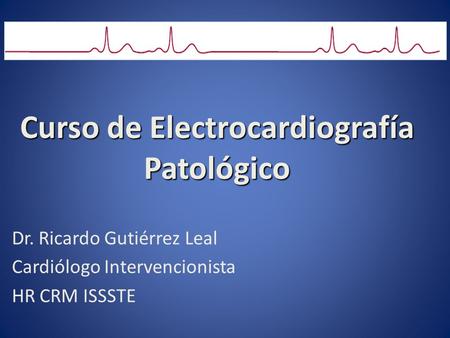 Curso de Electrocardiografía Patológico