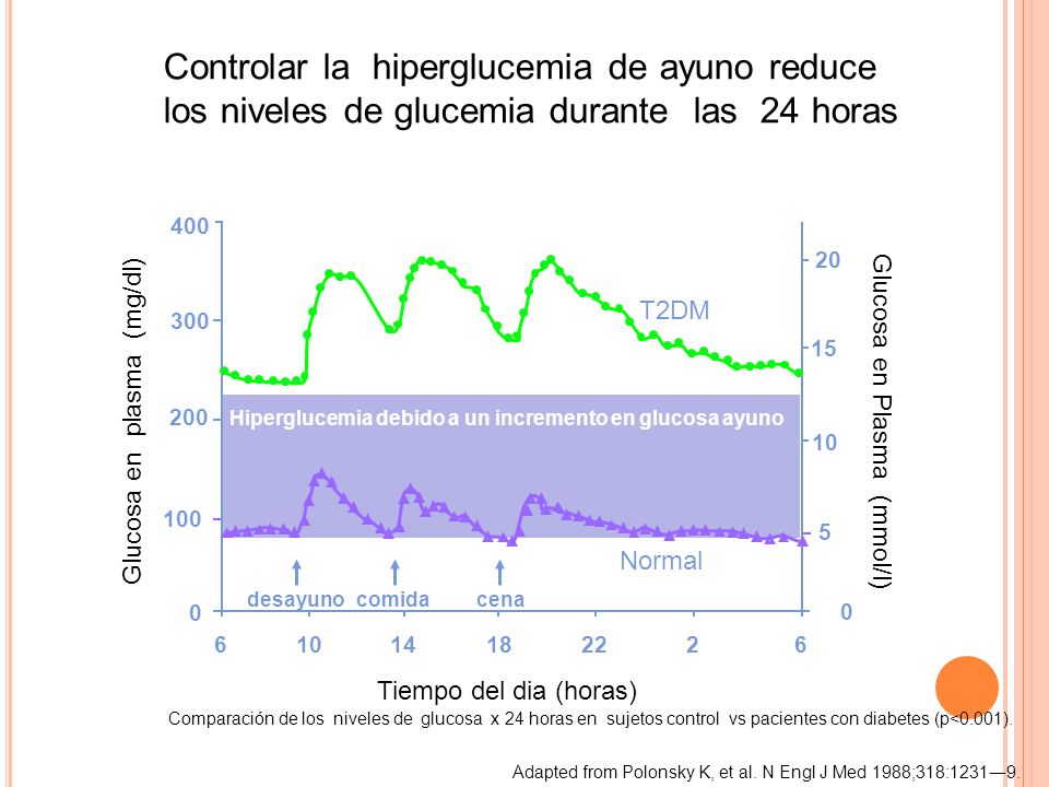 Tratamiento con Insulina en la Diabetes Mellitus tipo 2 Tratamiento con Insulina en la Diabetes Mellitus tipo 2