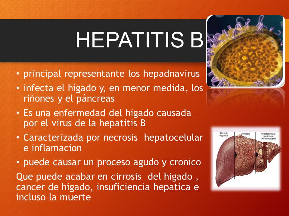 RESPUESTA INMUNE ANTE EL VIRUS DE LA HEPATITIS B - ppt RESPUESTA INMUNE ANTE EL VIRUS DE LA HEPATITIS B - ppt
