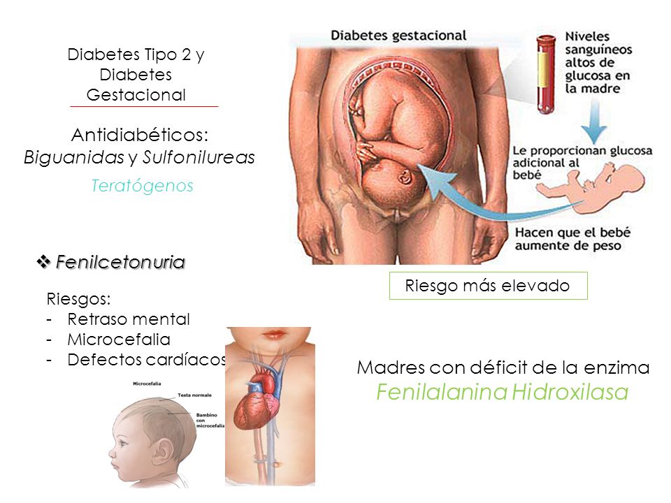 Anomalías Congénitas y Diagnóstico Prenatal - ppt descargar Anomalías Congénitas y Diagnóstico Prenatal - ppt descargar