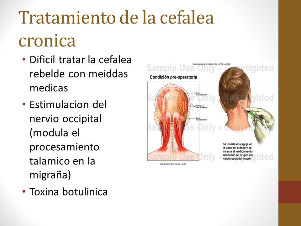 Dr. Gustavo Meza Neurología UPAP ppt descargar Dr. Gustavo Meza Neurología UPAP ppt descargar