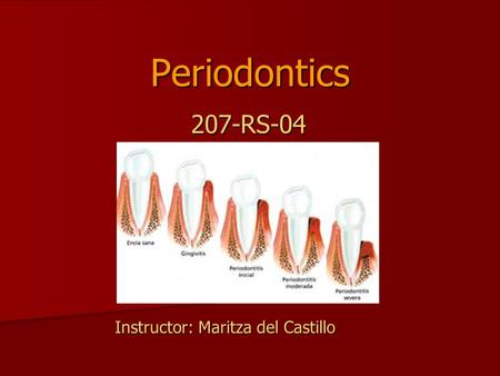 Periodontics 207-RS-04 207-RS-04 Instructor: Maritza del Castillo.