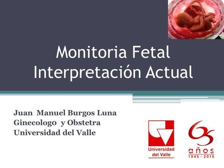 Monitoria Fetal Interpretación Actual
