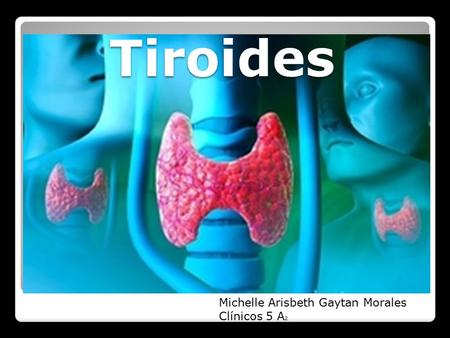 Tiroides Michelle Arisbeth Gaytan Morales Clínicos 5 A2.