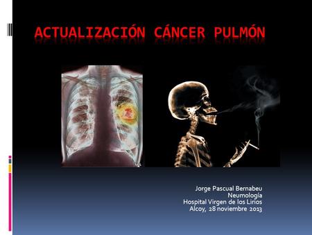 ACTUALIZACIÓN cáncer pulmón
