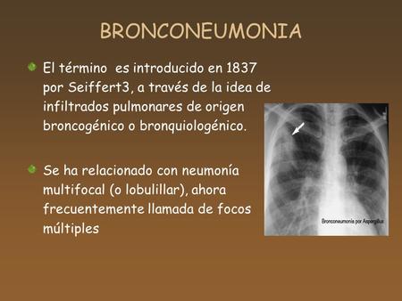BRONCONEUMONIA El término es introducido en 1837 por Seiffert3, a través de la idea de infiltrados pulmonares de origen broncogénico o bronquiologénico.