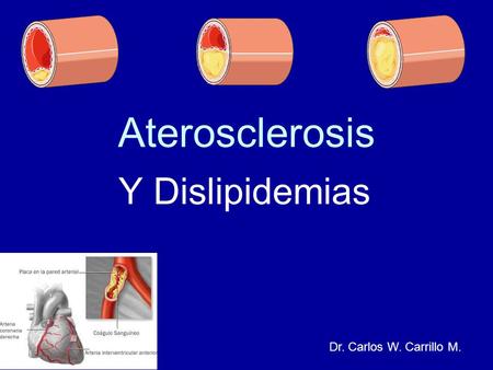 Aterosclerosis Y Dislipidemias Dr. Carlos W. Carrillo M.