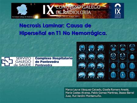 Necrosis Laminar: Causa de Hiperseñal en T1 No Hemorrágica.