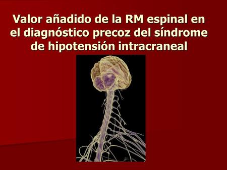OBJETIVOS El síndrome de hipotensión intracraneal espontáneo (SHI) se presenta con hipotensión ortostática y dolor de cabeza. El diagnóstico se basa en.