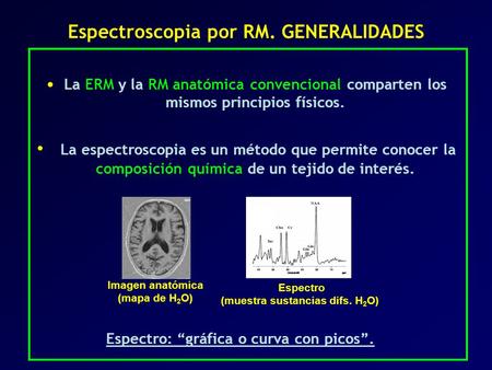Espectroscopia por RM. GENERALIDADES