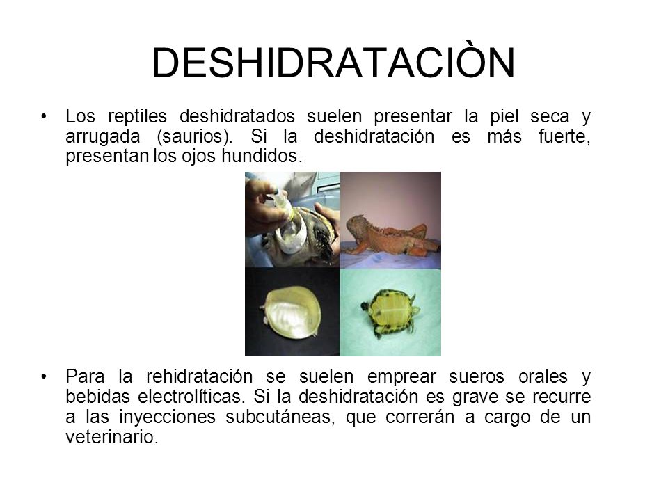 Arrojar el peso es cuántas calorías por día es necesario quemar