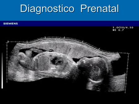 Diagnostico Prenatal.