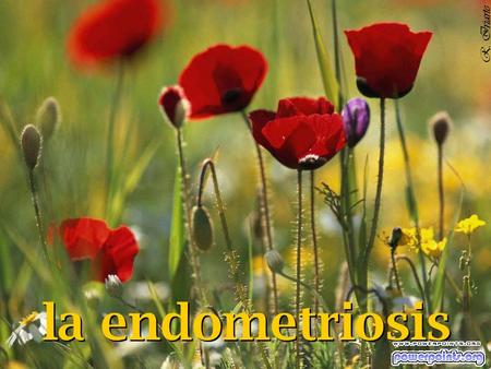 R. Iriarte la endometriosis.