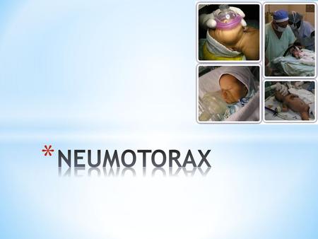 * El neumotórax es una acumulación de aire extrapulmonar dentro del tórax. * 1-2% de todos los RN presenta neumotórax asintomáticos, normalmente unilaterales.
