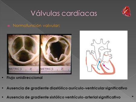 Válvulas cardíacas Normofunción valvular: Flujo unidireccional