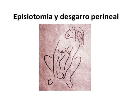 Episiotomia y desgarro perineal
