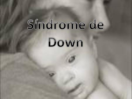 Síndrome de Down.