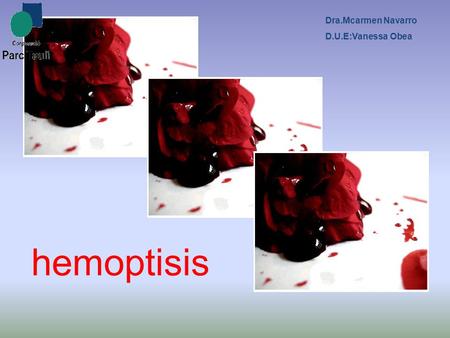 Dra.Mcarmen Navarro D.U.E:Vanessa Obea hemoptisis.