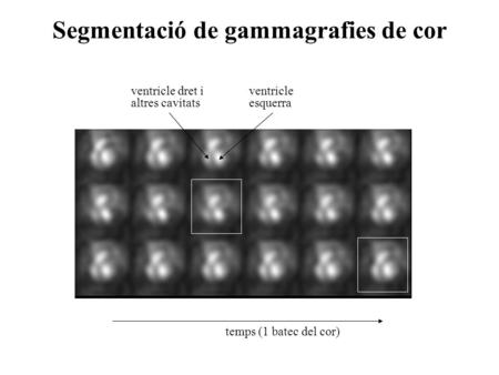 Segmentació de gammagrafies de cor ventricle esquerra temps (1 batec del cor) ventricle dret i altres cavitats.