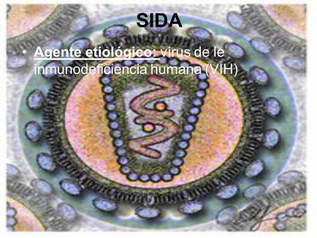 SIDA Agente etiológico: virus de le inmunodeficiencia humana (VIH)