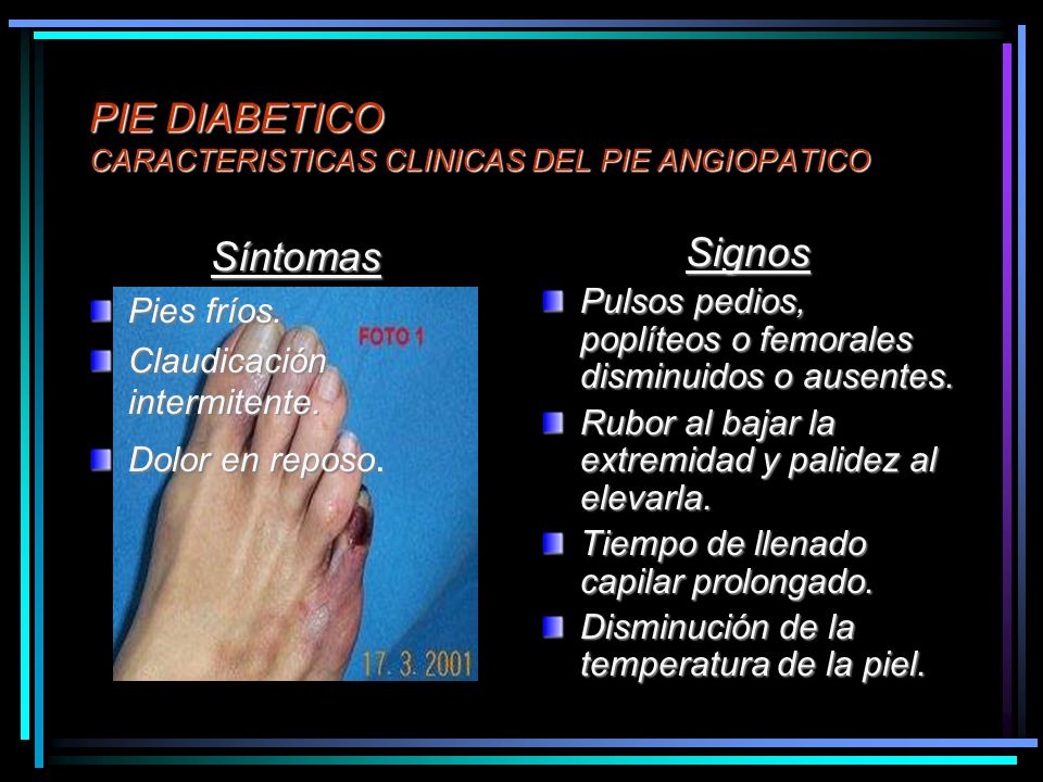 PIE DIABETICO DIABETES MELLITUS CURSO MONOGRAFICO HGZ N°1 PIE DIABETICO DIABETES MELLITUS CURSO MONOGRAFICO HGZ N°1