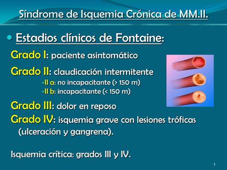 Síndrome de Isquemia Crónica de MM.II.