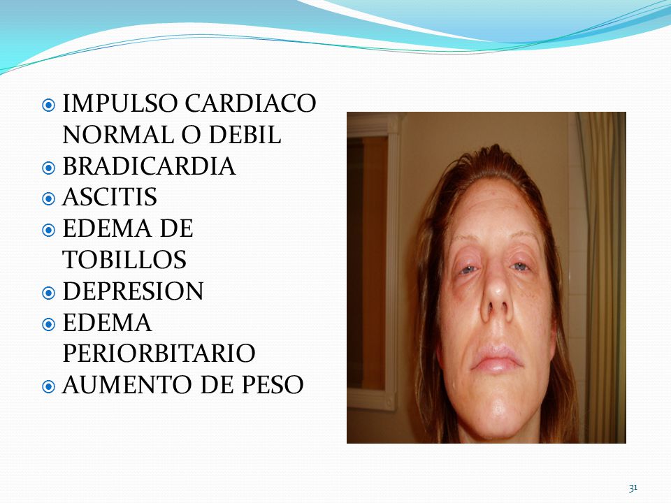 comidas para eliminar grasa del abdomen comidas para eliminar grasa del abdomen