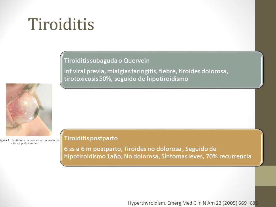 Enfermedad tiroidea y anestesia - ppt video online descargar Enfermedad tiroidea y anestesia - ppt video online descargar