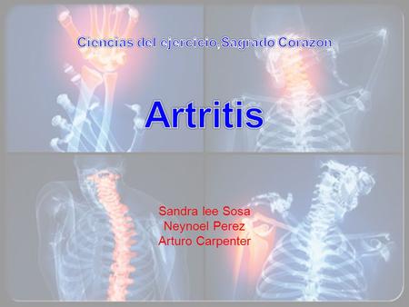 Ciencias del ejercicio,Sagrado Corazon Artritis