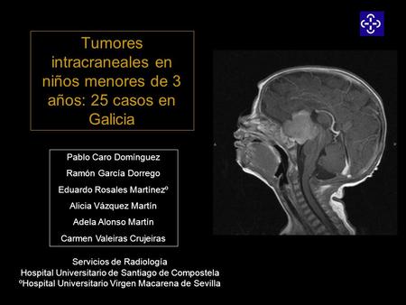 Tumores intracraneales en niños menores de 3 años: 25 casos en Galicia
