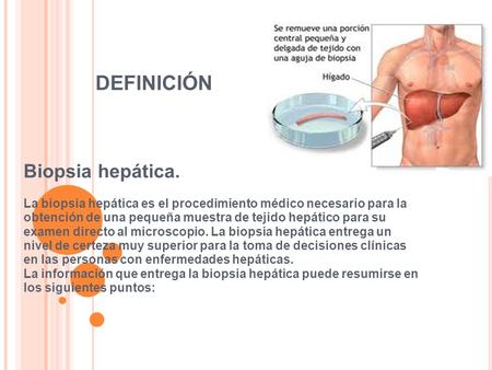 DEFINICIÓN Biopsia hepática.