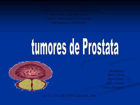 tumores de Prostata UNIVERSIDAD NACIONAL EXPERIMENTAL