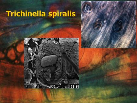 Trichinella spiralis.