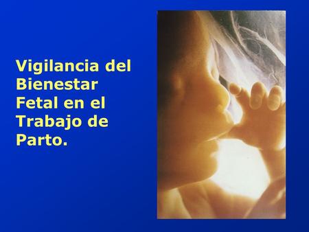 Vigilancia del Bienestar Fetal en el Trabajo de Parto.