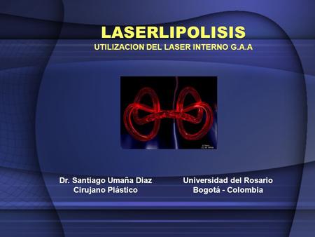 UTILIZACION DEL LASER INTERNO G.A.A Universidad del Rosario