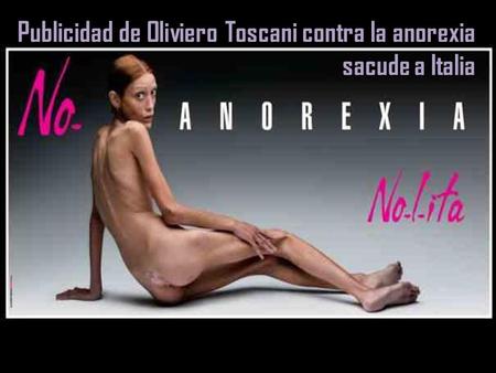 Publicidad de Oliviero Toscani contra la anorexia sacude a Italia
