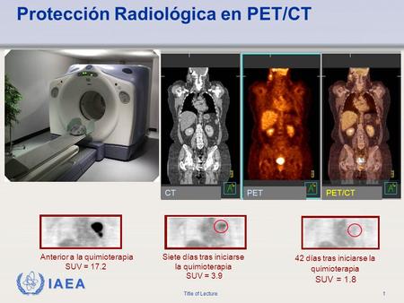 Protección Radiológica en PET/CT
