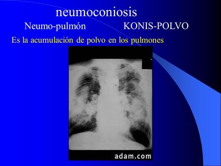 neumoconiosis Neumo-pulmón KONIS-POLVO