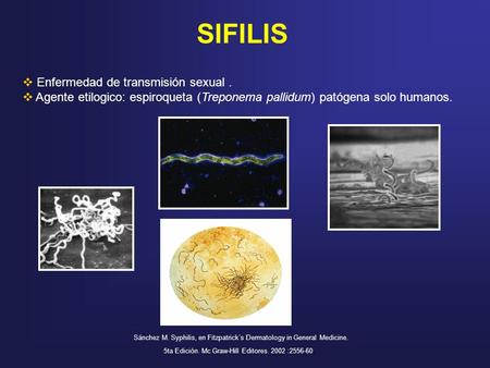 SIFILIS Enfermedad de transmisión sexual .
