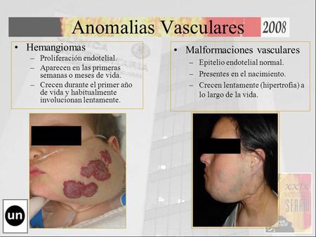 Anomalias Vasculares Hemangiomas Malformaciones vasculares
