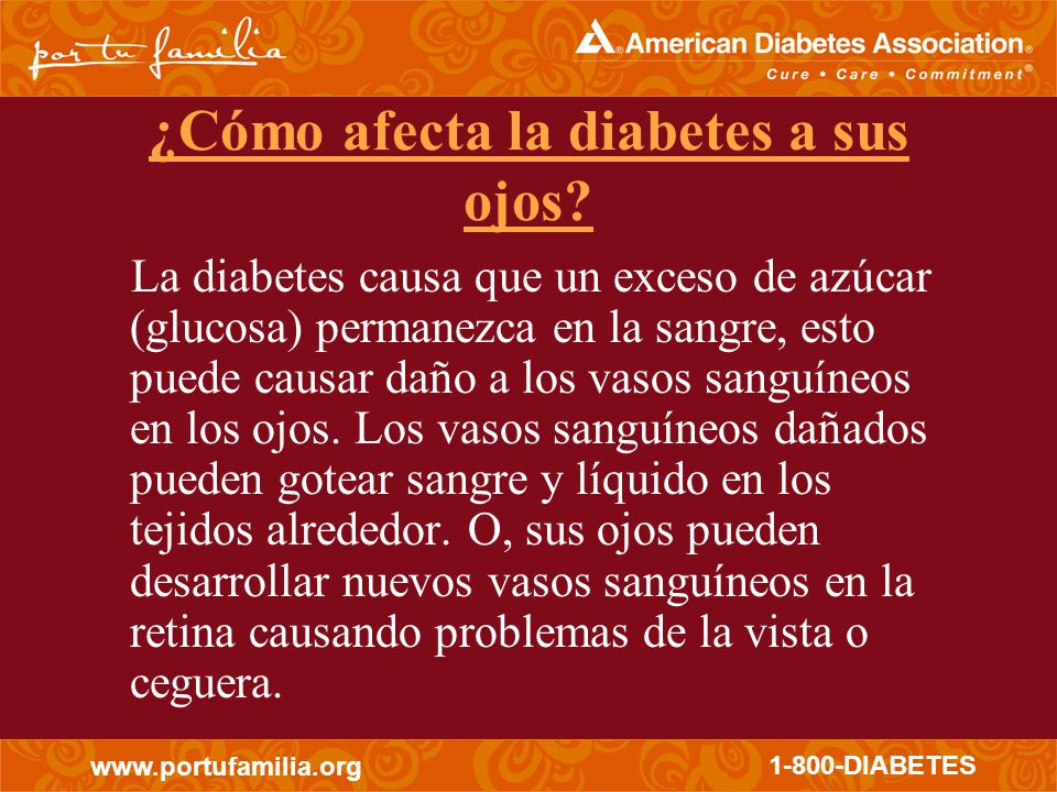 Con los Ojos Abiertos With Open Eyes Presentado por: - ppt Con los Ojos Abiertos With Open Eyes Presentado por: - ppt