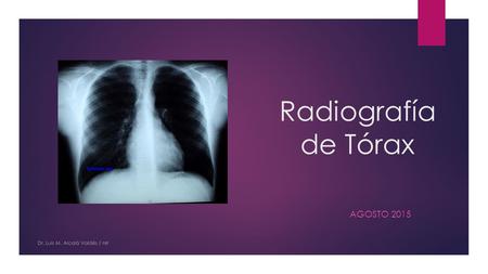 Radiografía de Tórax Agosto 2015 Dr. Luis M. Alcalá Valdés / nrr.