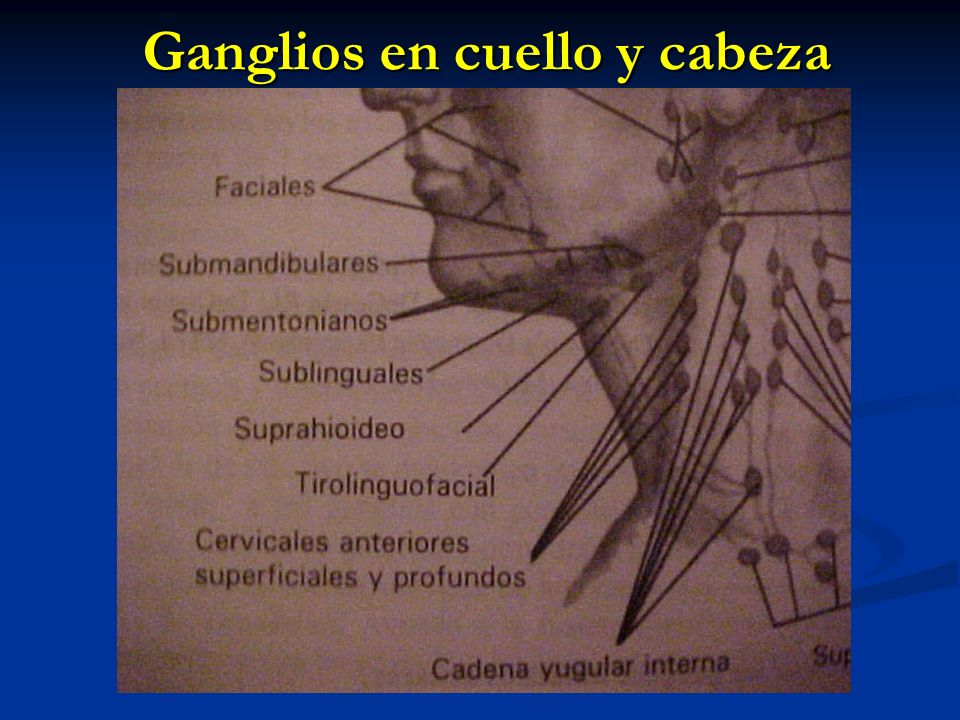 grupos ganglionares en cuello examen de los ganglios linf 225 ticos ppt video online descargar grupos ganglionares en cuello examen de los ganglios linf 225 ticos ppt video online descargar