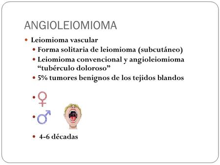 ANGIOLEIOMIOMA Leiomioma vascular
